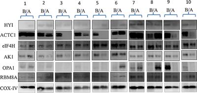 Isobaric Tags for Relative and Absolute Quantitation Identification of Blood Proteins Relevant to Paroxetine Response in Patients With Major Depressive Disorder